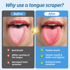 Aussumy Stainless Steel Tongue Scrapers
