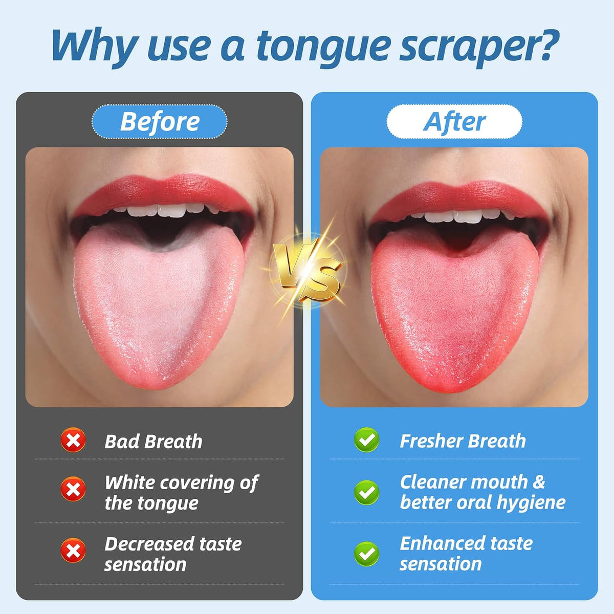 Aussumy Stainless Steel Tongue Scrapers