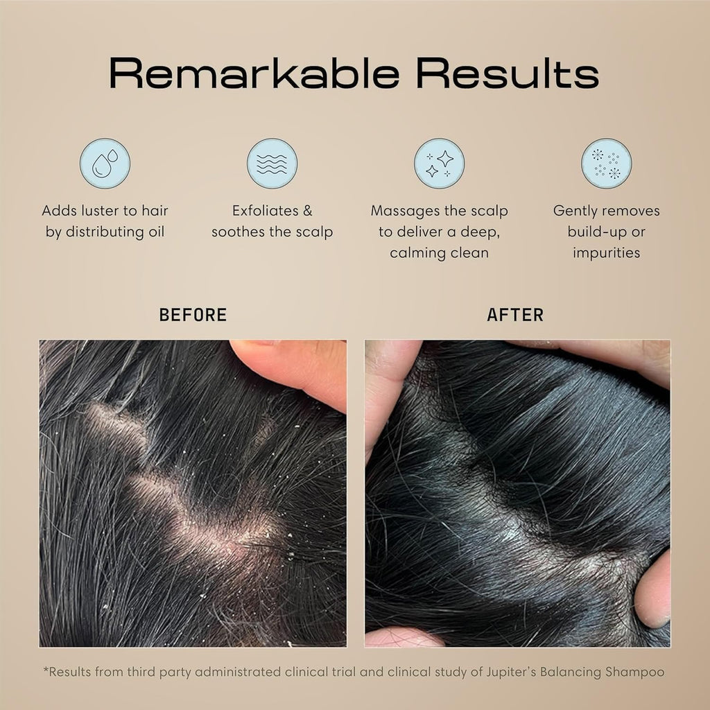 Jupiter Scalp Exfoliator Massager