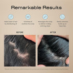 Jupiter Scalp Exfoliator Massager
