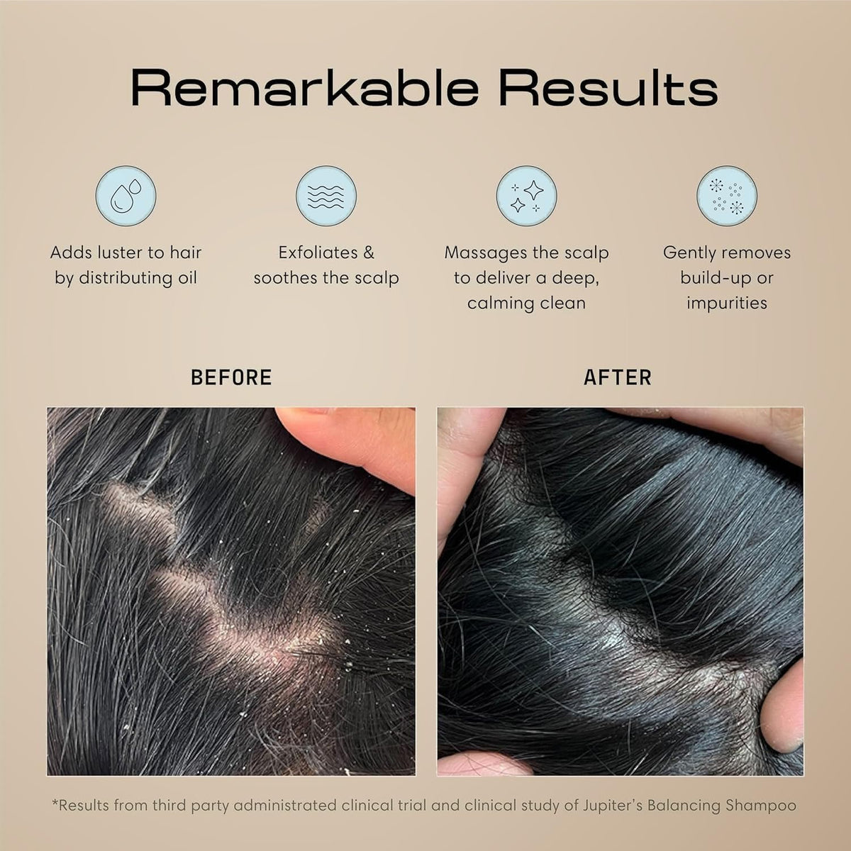 Jupiter Scalp Exfoliator Massager